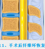 椎間孔鏡最低價